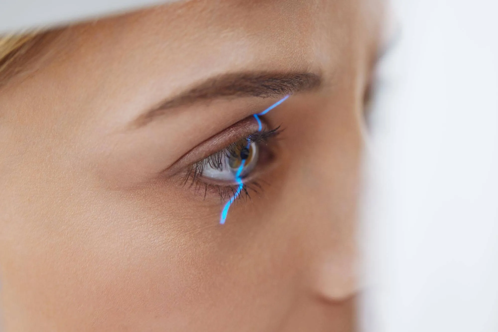 Comparativa entre IPL y termoterapia palpebral BLOG Grupo Castanera