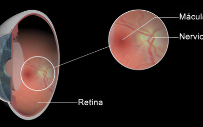 Salud visual: campimetría